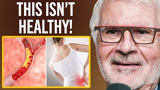 The Shocking Truth About Keto Cholesterol amp Signs Youre Not Healthy  Dr Steven Gundry [upl. by Glynias]