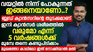 ബ്ലഡ് ക്യാൻസർ കോശങ്ങൾ ശരീരത്തിൽ ഉണ്ടെങ്കിൽ ആദ്യം കാണിക്കുന്ന ലക്ഷണങ്ങൾ  blood cancer symptoms [upl. by Stoughton936]