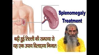 बढ़ी हुई तिल्ली की समस्या से यह उपाय दिलाएगा निजात  Enlarged Spleen Treatment in Ayurveda [upl. by Rodavlas]