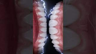 Dental Animated Video From Photos Dentiphoto App dentalphotography dentalmarketing dentiphoto [upl. by Romo234]