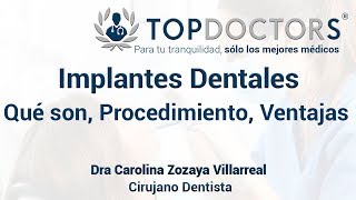 Implantes Dentales Qué son Procedimiento y Ventajas [upl. by Wier369]