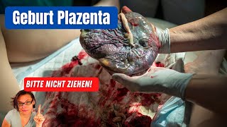 Geburt der Plazenta  warum das Ziehen an der Nabelnschnur vermieden werden sollte [upl. by Cortie323]