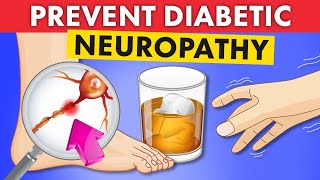 How To PREVENT Diabetic Neuropathy  Do This NOW [upl. by Ahsinit]