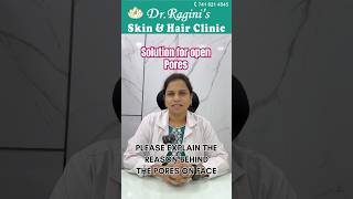 Best Treatments for Acne Scars  Dr Ragini Skin amp Hair Clinic [upl. by Eilrak]