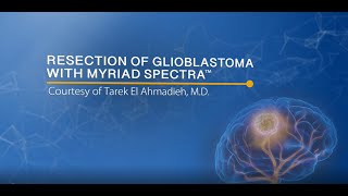 Glioblastoma Resection with Myriad SPECTRA Kimberly Hoang [upl. by Hanyaz]