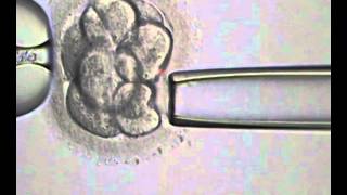 Laserassisted Blastomere Biopsy using Hamilton Thorne laser [upl. by Shrier]