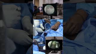 DOACON2024 Shoulder Arthroscopy Workshop  Dr baba Saheb Ambedkar Medical College and Hospital [upl. by Elisha]