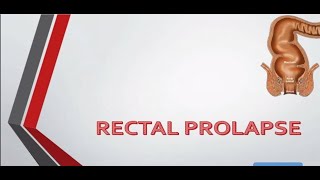 Rectal Prolapse causes and treatment – General Surgery Lecture [upl. by Nevaj]