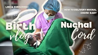 Normal delivery with nuchal cord  birth vlog [upl. by Trow]