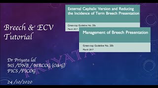 Assisted breech delivery and External Cephalic Version [upl. by Elna]