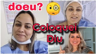 COLOQUEI DIU MIRENA NO HOSPITAL COM ANESTESIA COMO FOI A EXPERIÊNCIA [upl. by Eaton]