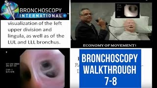 Bronchoscopy Step by Step Walkthrough 78 [upl. by Ecnaiva]