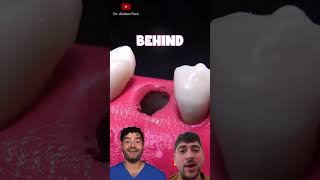 dental Digest amazing short video food satisfying mukbang experiment funny tiny [upl. by Ahseneuq]