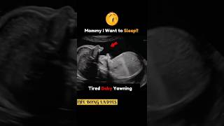 Baby Caught Yawning DuringUltrasound Scan 😍🤩 fetalultrasound pregnancy baby trendingshort [upl. by Anaerdna591]