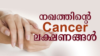 നഖത്തിന്റെ Cancer ലക്ഷണങ്ങൾ  Symptoms And Causes Of Nail Cancer  Health Care Tips [upl. by Atekram]