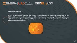 Identification of Ocular Disease from fundus images using CNNwith Transfer Learning [upl. by Denby]