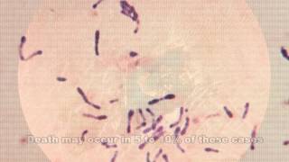 Corynebacterium diphtheriae amp Diphtheria [upl. by Fadil]