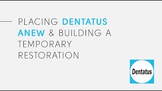 Dentatus ANEW Placement amp Building A Temporary Restoration [upl. by Nugesulo172]