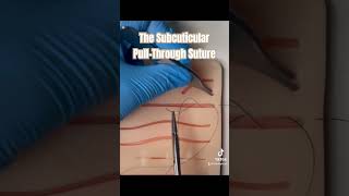 The Suture all adults and children love suture nursepractioner doctor sutures medicalschool [upl. by Tsui]