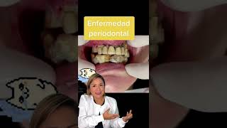 La enfermedad periodontal no solo afecta tus encías también pone en riesgo tus dientes [upl. by Justicz]