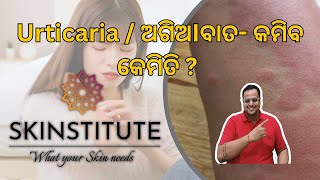 Urticaria  ଅଗିଅIବାତ କମିବ କେମିତି  Ft Dr Kumar Abhishek SKINSTITUTE [upl. by Aira]