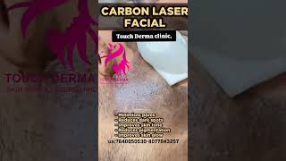 hyper pigmentation Acneblack dotsCarbon peeling at TOUCH Derma clinicus80778432577840050530 [upl. by Elrahc131]