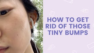 How to Get Rid of Those Tiny Bumps  FaceTory [upl. by Howzell]