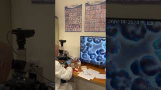 Im studying the condition of your 🩸 medicine microscope doctor channel shorts [upl. by Townie]