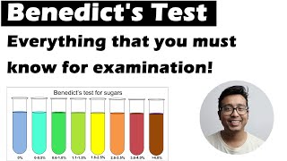 BENEDICTS TEST  The ultimate guide for biochemistry practical viva examination [upl. by Persse]