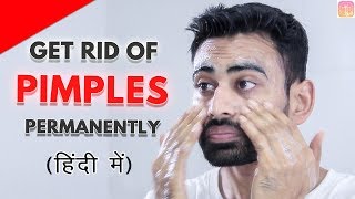 Get Rid of Pimples amp Acne Permanently in 2 Steps Works 100  Fit Tuber Hindi [upl. by Linad514]