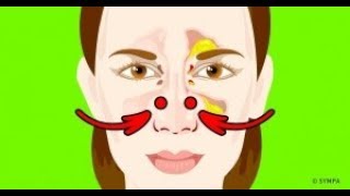 5 Façons efficaces de déboucher ton nez rapidement [upl. by Maddie]