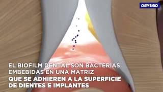 ¿Qué es el biofilm dental [upl. by Birkner]