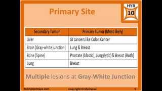 Metastasis Cancer Nomenclature Tumor Nomenclature Lymphatic Spread Metalloproteinase [upl. by Seluj]