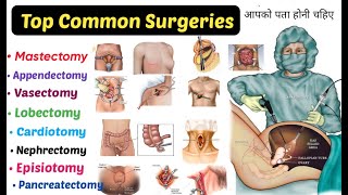 Top 15 Common Surgeries  You Should Know  mastectomy Appendectomy Lobectomyamp More [upl. by Macpherson]