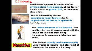 Parasitology ASU GIT Ancylostoma caninum amp Toxocara Dr Khaled Habib [upl. by Yruam]