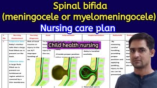 Nursing care plan on myelomeningoceleNursing care plan meningoceleSpinal bifida nursing care plan [upl. by Notsahc]