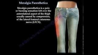 Meralgia Paresthetica  Everything You Need To Know  Dr Nabil Ebraheim [upl. by Dazhehs]