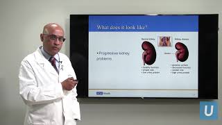 Kidney Disease What You Should Know  Anjay Rastogi MD  UCLAMDChat [upl. by Nalyac]