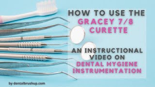 How to use the Gracey 78 Curette [upl. by Binetta]