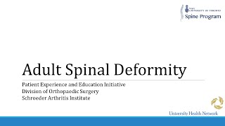 Adult Spinal Deformity [upl. by Daph]