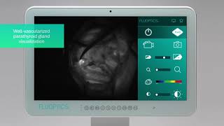 FLUOBEAM® IN ACTION  Endocrine surgery  Checking the parathyroid gland vascularization [upl. by Siroval]