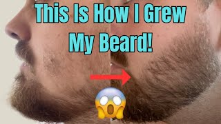 This Is How I Grew My Beard With Minoxidil And a Derma Stamp [upl. by Mariand738]