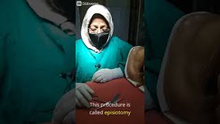 Episiotomy sciessor Part1 doctor delivery hospital nursingexperts pregnancy nursingstudents [upl. by Akkim]