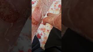 How to peel off dead skin  ASMR [upl. by Eelrihs9]