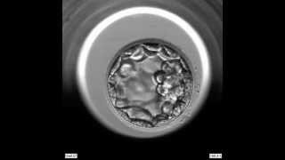 EmbryoScope Embryo Development  Blastocyst [upl. by Lucia151]