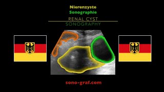 Sonographie  Nierenzyste [upl. by Suoirad67]