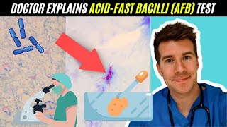 Doctor explains AcidFast Bacilli AFB test  Mycobacterium Tuberculosis TB [upl. by Yevoc]