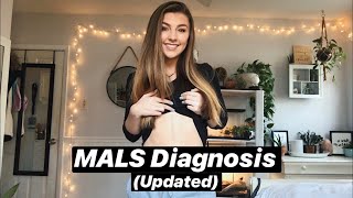 MALS Diagnosis amp Post Surgery Updated [upl. by Dreddy]