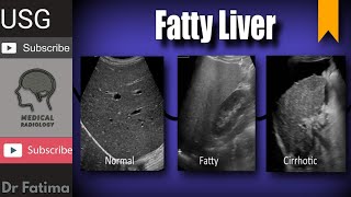 Liver normal echogenicity amp fatty liver with texture complete ultrasound lecture by DrFatima [upl. by Lodge878]