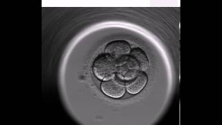 Blastocyst Video  Science at Boston IVF [upl. by Nitniuq]